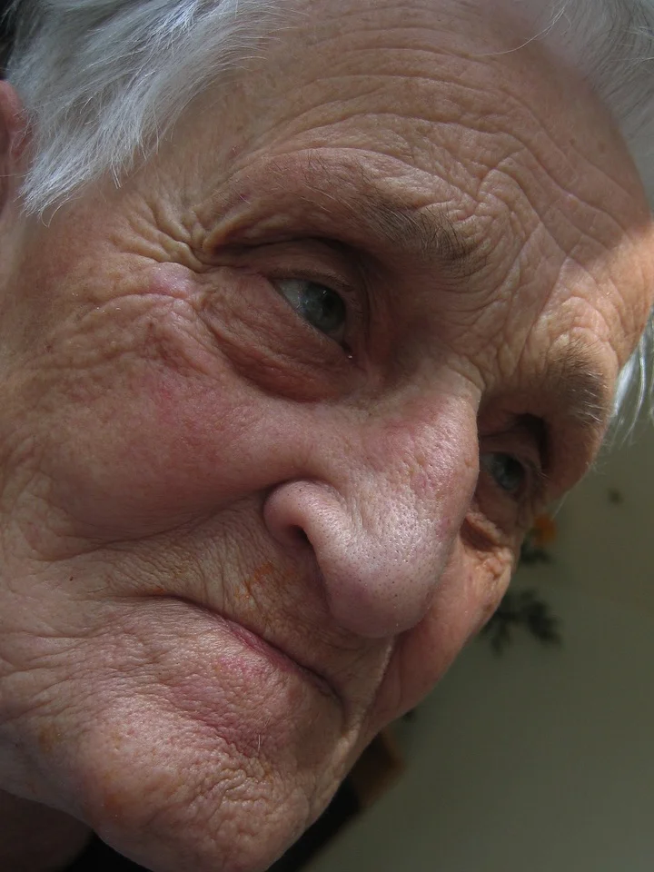 dementia patient face up close