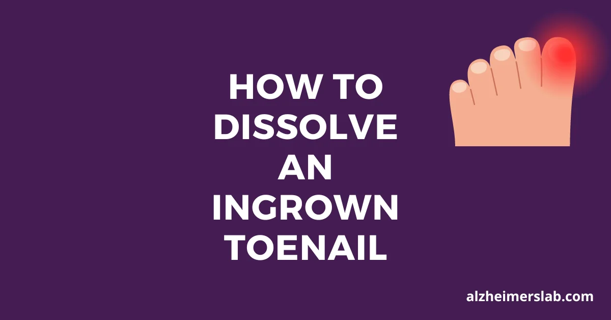 How to Dissolve an Ingrown Toenail: Simple Solutions