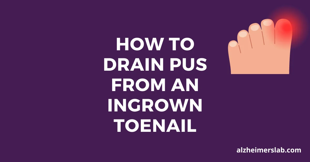 How to Drain Pus from an Ingrown Toenail: A Simple Guide
